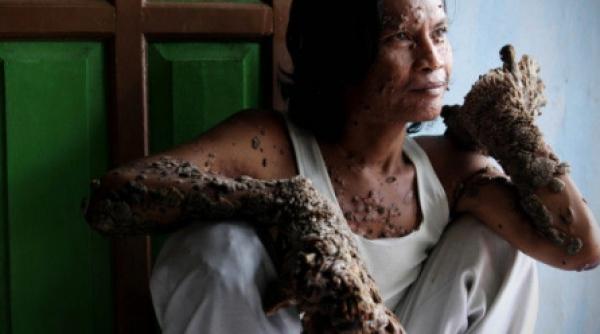 omul copac socheaza lumea