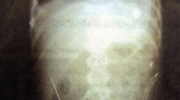 un brazilian a bagat 40 de ace in copil ca sa se razbune pe mama