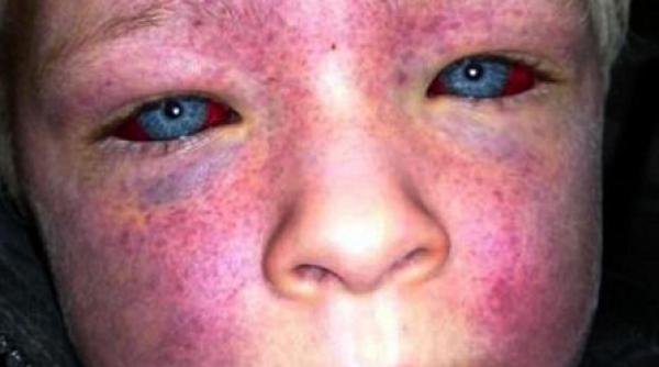 a supravietuit dupa ce a cazut intre doua scari rulante