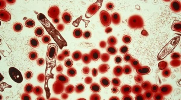 drogurile contaminate cu antrax continua sa ucida oameni