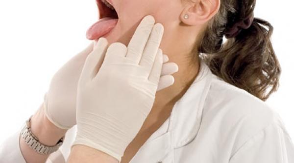 reumatismul articular acut