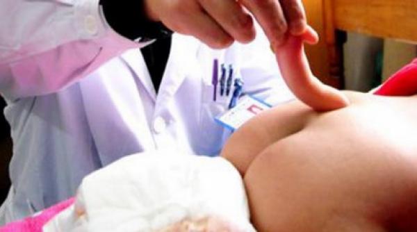 o fetita din china s a nascut cu coada