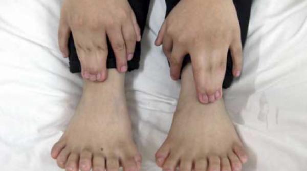 chinezul cu 31 de degete