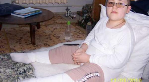 copilul cu oase de sticla