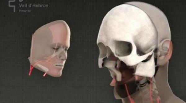 spaniolii au facut primul transplant de fata complet