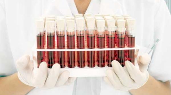 asociatia lupus romania