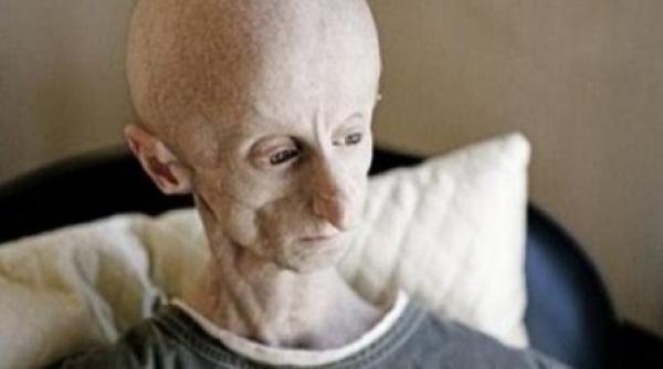 omul cu chip de extraterestru are 25 de ani este dj si traieste in africa