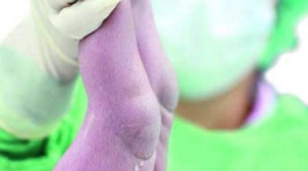 despre scosul si bagatul inapoi in mame