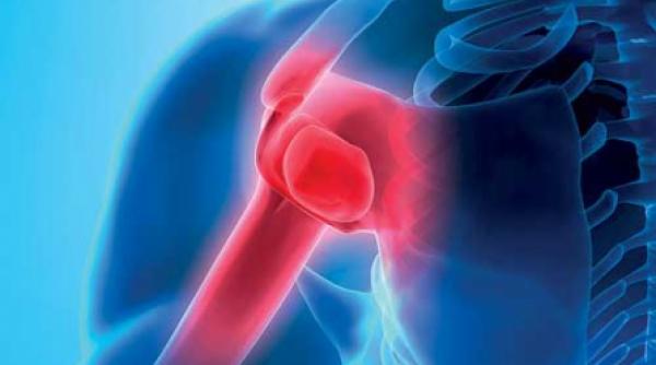 reumatismul articular acut