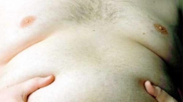 stomacul obezului fie cu balon fie cu inel