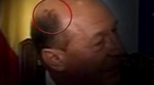 presedintia despre petele suspecte aparute pe capul lui traian basescu nu sunt motive de ingrijorare