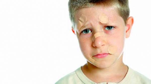 lovituri care dau batai de cap