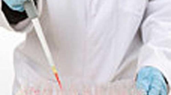 managementul leucemiei mieloide cronice