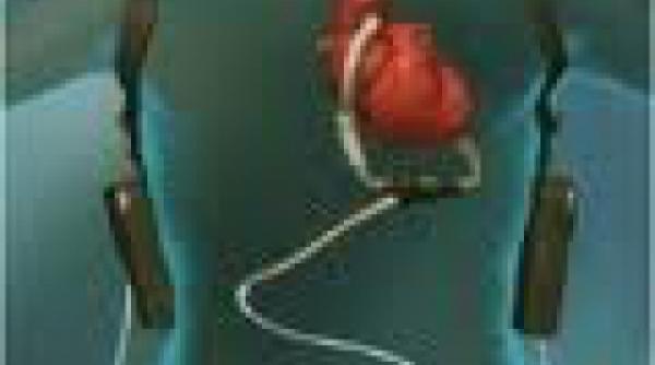 prima inima artificiala permanenta implantata unui adolescent