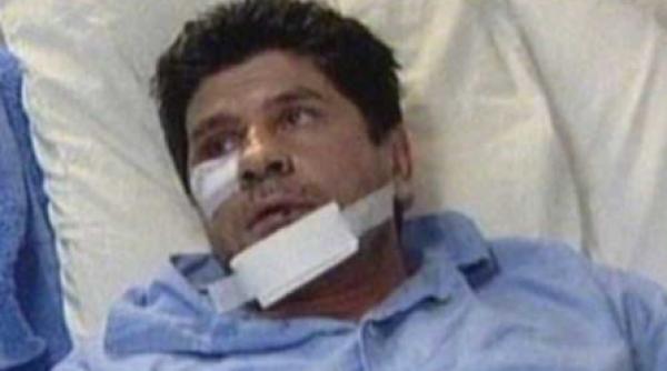 lui ogica i au iesit 4 din 32 dinti