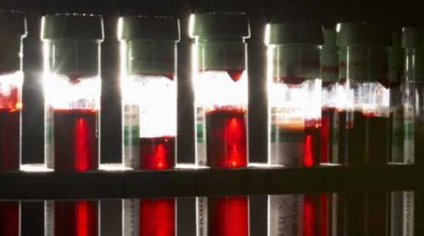 hemofilia poate fi controlata