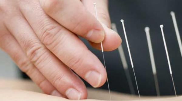 acupunctura te pazeste de infarct