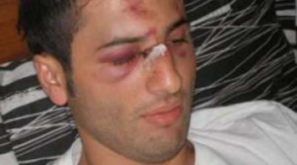 ospatarul ii cere lui mutu sa i plateasca operatia estetica pentru a renunta la acuzatii