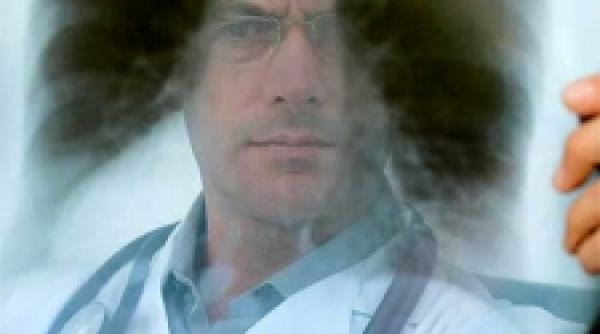 aprindere la plamani