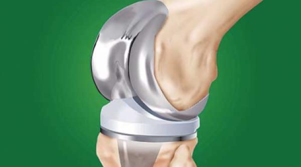 secretele spondilozei