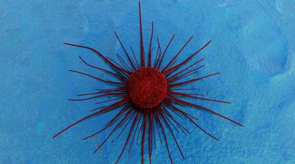 aparatul care tinteste cancerul