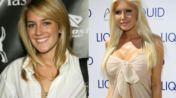 heidi montag operatiile estetice mi au ruinat cariera voi arata toata viata ca edward scissorhands