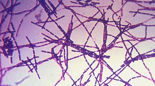 stare de urgenta la o ferma din rusia focar de antrax