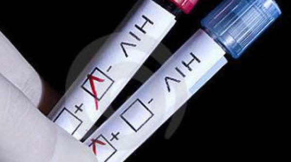 persoanele seropozitive fara tratament