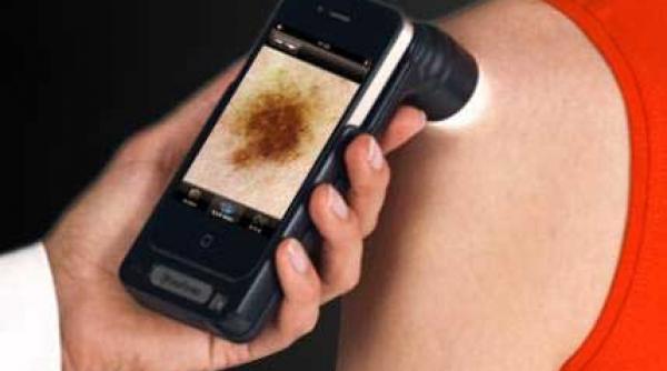 depistarea cancerului se va face cu telefonul mobil