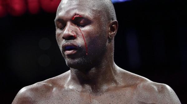 box jo jo dan l a invins pe steve forbes cu video