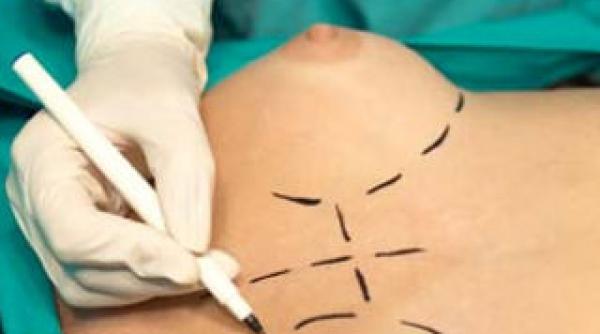 parlamentul european deconteaza operatiile de reducere a sanilor