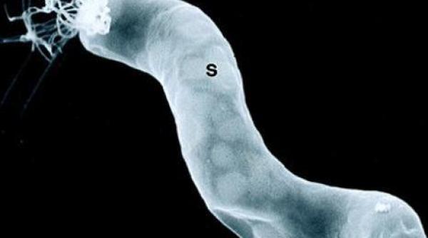 un cercetator nasa sustine ca a descoperit bacterii extraterestre