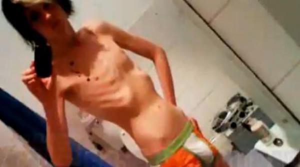 povestea unui anorexic corpul meu a ajuns sa se manance singur pe interior