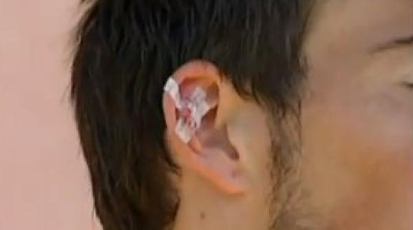 eliminat dupa ce a muscat un adversar de ureche