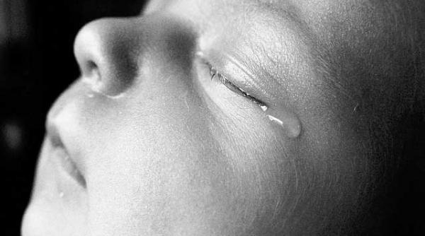 copiii imperfecti sunt ucisi in burta mamei