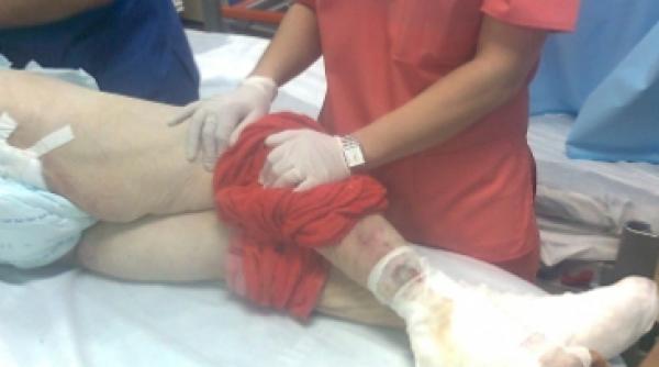 pacienta lui cseke cu rani pana la os a murit