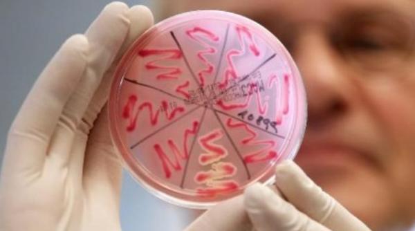 bilantul mortilor din cauza e coli a ajuns la 19