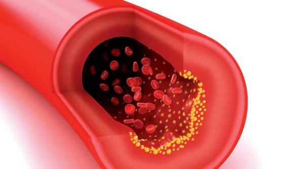 atentie la trombocite