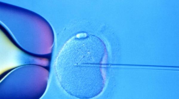 suedezii au descoperit cum sa reduca riscul de sarcina multipla la fertilizarea in vitro