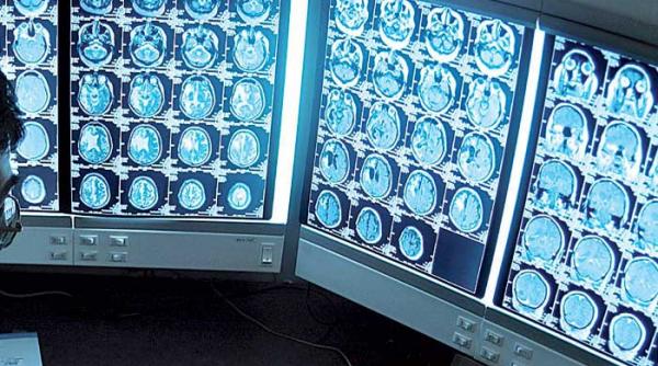 cele mai noi aparate de imagistica medicala