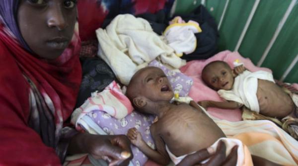 29 000 de copii somalezi au murit de foame in ultimele trei luni