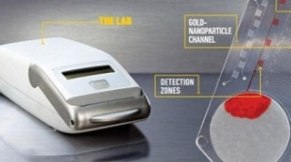 virusul hiv si sifilisul vor fi depistate in cateva minute