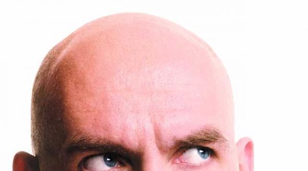 domnilor atentie la chelie