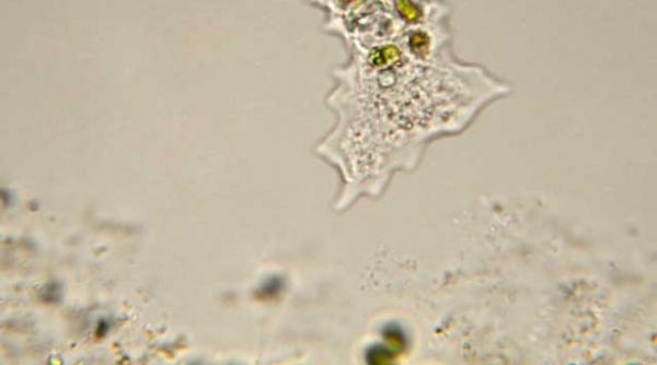 amoeba care se hraneste cu creier uman naegleria fowleri