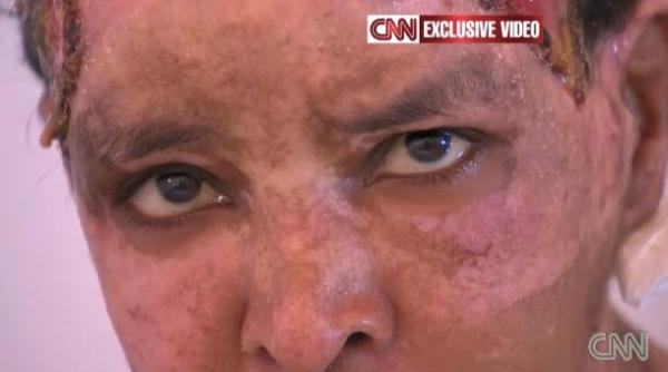 bona nepotilor lui gaddafi mutilata cu apa fiarta de nora dictatorului libian