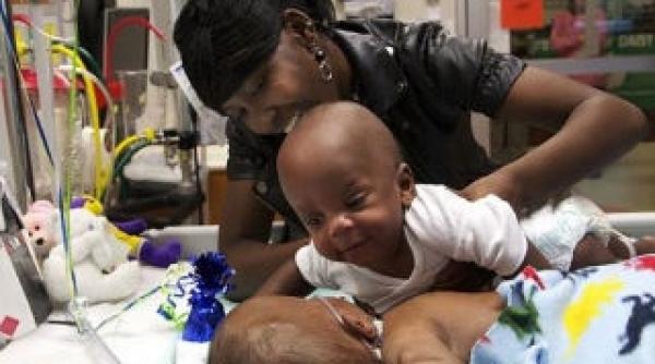 minune medicala in sua doi gemeni siamezi uniti in zona bazinului au fost separati cu succes foto video