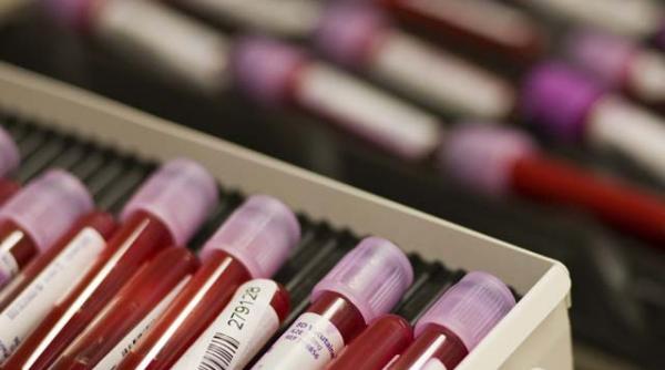 analize medicale gratuite pentru pensionarii bucuresteni