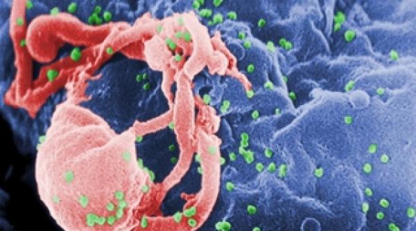 un nou vaccin ar putea transforma virusul hiv intr o infectie minora