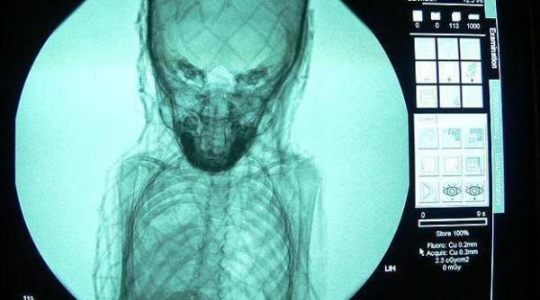 misterul unei mumii dezvaluit de o radiografie