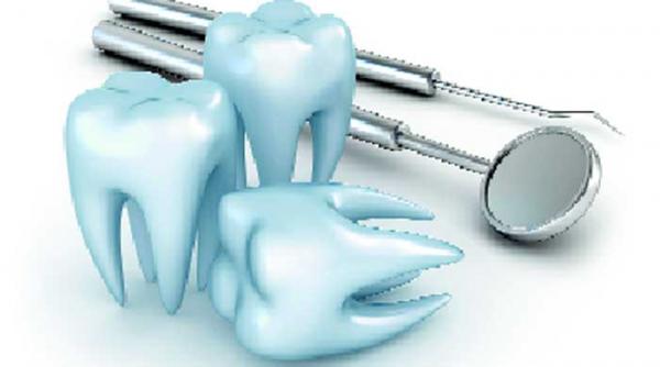 albirea dentara profesionala